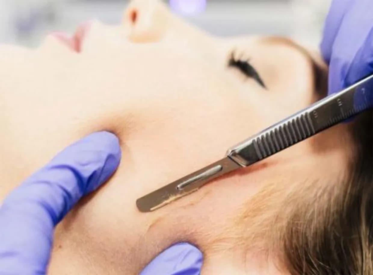 How Often Should You Schedule a Dermaplane Facial?