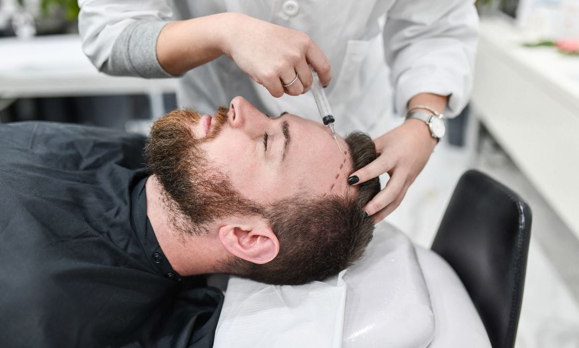 Affordable Hair Transplant UK Options with World-Class Care